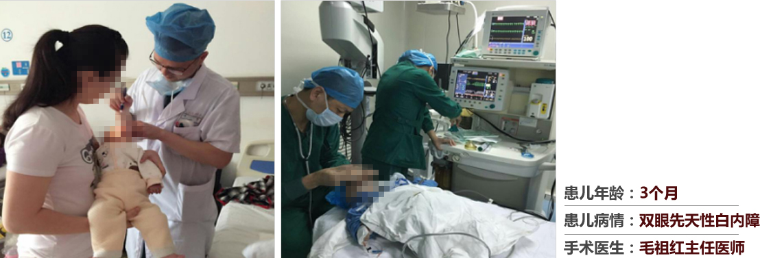 患兒年齡：3個月，患兒病情：雙眼先天性白內(nèi)障，手術(shù)醫(yī)生：毛祖紅主任醫(yī)師