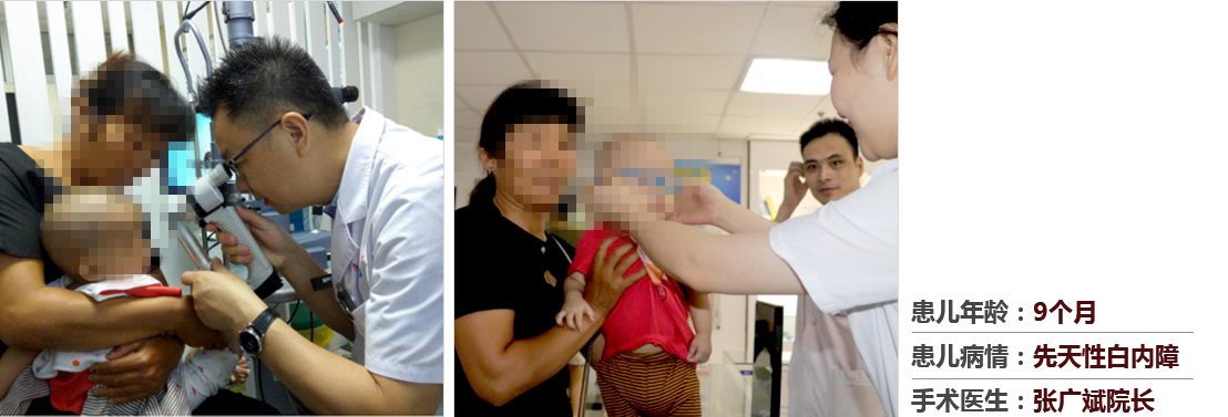 患兒年齡：9個月，患兒病情：先天性白內(nèi)障，手術(shù)醫(yī)生：張廣斌院長