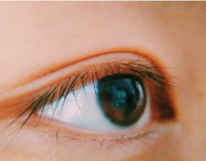 倒睫是由什么原因引起的？