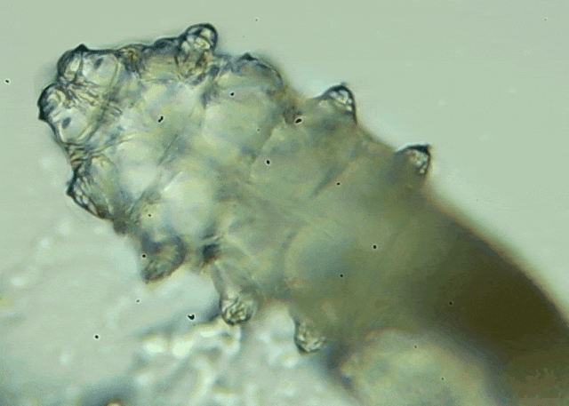 睫毛上驚現(xiàn)80只螨蟲！別揉了，快自查下你的眼睛有沒有......