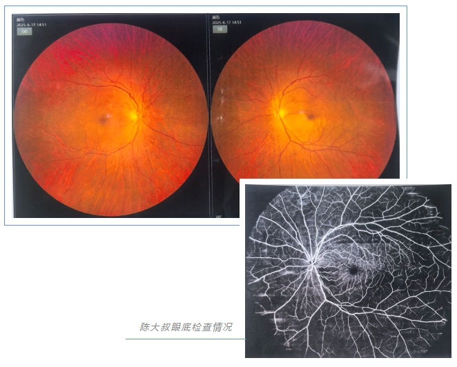 視網(wǎng)膜動脈阻塞